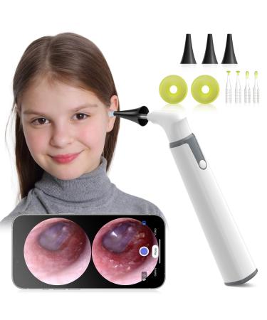 Anykit Wireless Otoscope Ear Camera with Dual View 3.9mm 720PHD WiFi Ear Scope with Ear Wax Removal Tool for Kids and Adults & Pets Compatible with Android and iPhone