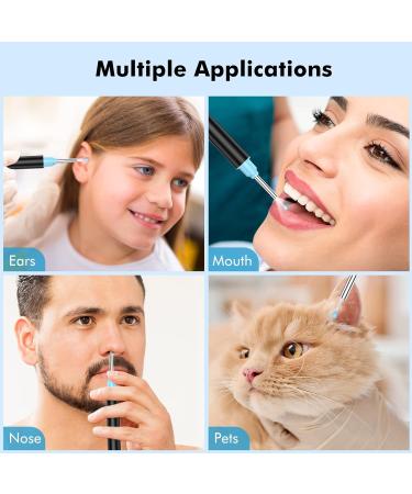 1080P FHD Ear Wax Removal Kit Camera with Anti-Fall Off Eartips - Wireless Ear Cleaner Otoscope for iPhone, iPad, Android - 6 LED Lights - Suitable for Adults, Kids, and Pets - Buy Online on GoSupps.com