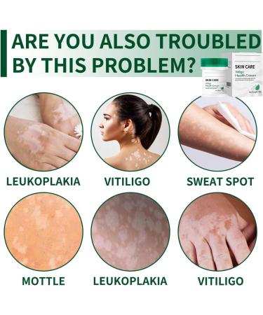 Moisturizer for the skin 35 g brightening and soothing face cream intensive face and body lotion for women deeply moisturizes for day and night beauty care at home - Buy Online on GoSupps.com