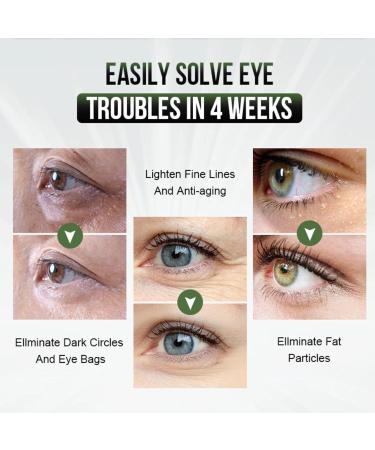 Tea Tree Eye Cream Refreshing Eye Cream Dark Circle Eye Cream Eye Bags Remover Of Tea Tree Eye Serum Fade Fine Lines Puffy Eyes Bags Under Eyes Skincare Remove Fade Fine Line Crow's Feet - Buy Online on GoSupps.com