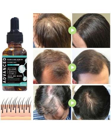 higyee Liquid Biotin Organic Hair Growth Essence Powerful Vitamin B Supplement Strong Nails and Healthy Skin Extra Strength Gel Drops 1 OZ for Women and Men - Buy Online on GoSupps.com