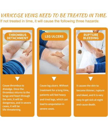 2023 New Varicose Veins Miracle Cream - Natural Treatment for Legs (2 Pack) | International Shipping Available - Buy Online on GoSupps.com
