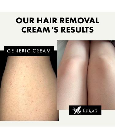 Bikini Hair Removal Cream with Aloe Vera - Gentle & Sulphate-Free Shaving Cream for Women - Buy Online on GoSupps.com