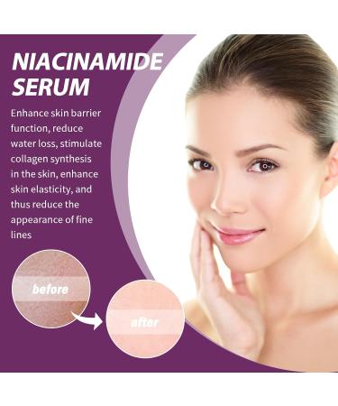  SKZKK Niacinamide Face Serum 20%: Brightening Firming Moisturizing Anti-Wrinkle Evening Smoothing Fine Lines Reducing Pigmentation Pore Care for Sensitive Skin (2pcs) - Buy Online on GoSupps.com