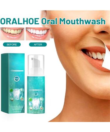 Furzero Smartsmile Mouthwash - 60ml Total Care Oral Rinse for Healthy Teeth (2PC) | Buy Internationally - Buy Online on GoSupps.com