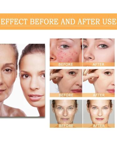 240ml Glycolic Acid 7% Toning Resurfacing Solution Hydrating Toning Solution Glycolic Sour 7% Toner Skincare Hyaluronic Acid Serum Hyaluronic Acid Serum For Face Face Serum For Women Serums Skincare - Buy Online on GoSupps.com