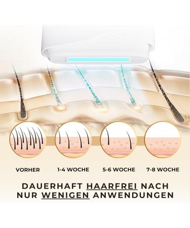 IPL Laser Hair Removal Device - 990 000 Impulses 5 Levels Painless for Men & Women - Optimal Cooling Function for Body & Face - Buy Online on GoSupps.com
