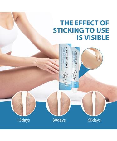 Raura Varicose Veins Cream Varicose Veins Cream Improves blood circulation - Buy Online on GoSupps.com