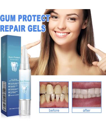  homomdy Gum Repair Gel - Soothing gel for gum repair - To improve oral health - Protects and whitens teeth - Deep cleans for fresh breath - Buy Online on GoSupps.com