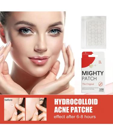 Original Hydrocolloid Acne Patches - 108 Count Spot Stickers for Zits & Blemishes | International Shipping - Buy Online on GoSupps.com