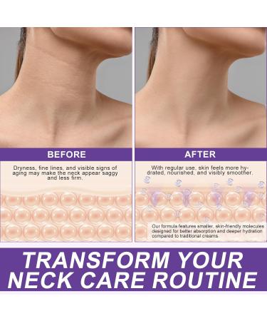 Uocasi AH8 Neck Firming Cream Firm TightLift Neck Cream with 360 Roller MassageReduce Wrinkles Fine Lines and Double ChinFirm and Lift Sagging SkinHydration Skin Tightening Cream120g - Buy Online on GoSupps.com