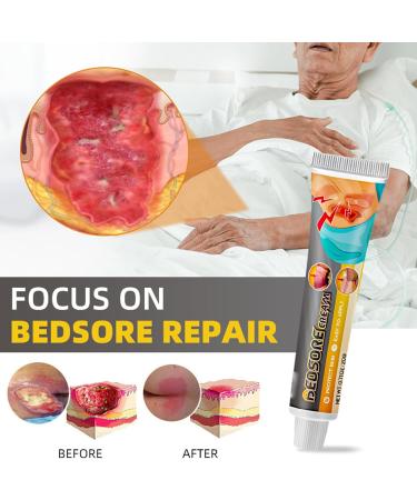 Bedsore Cream Pressure Sore Relief Cream Bed Sore Cream Fast Acting Fast Wound Healing Gel 20g - Buy Online on GoSupps.com