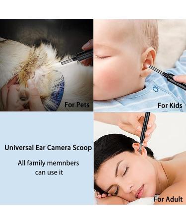 Wireless Ear Wax Removal Tool with Camera - Professional Ear Inspection System for Smart Devices - Buy Online on GoSupps.com
