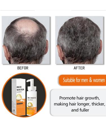 Rice water shampoo 200 ml rice water shampoo cleansing hair nourishes frizz dry hair hair shine care shampoo shampoo - Buy Online on GoSupps.com