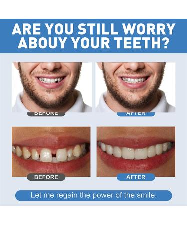 Temporary Tooth Repair Kit - DIY Replacement for Missing & Broken Teeth - Heat Fit Beads for Confident Smile - Buy Online on GoSupps.com