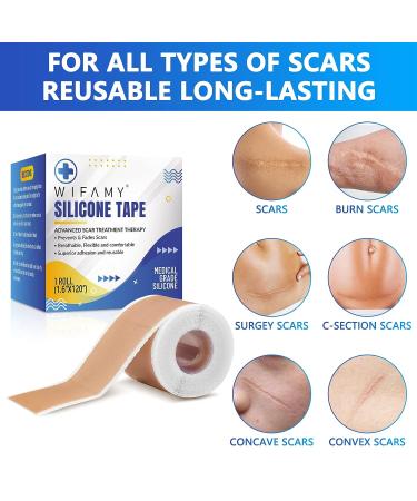 Silicone Scar Sheets & Tape 1.6x120 - Reusable Treatment for C-Section, Burn, Surgery & Acne Scars - Buy Online on GoSupps.com