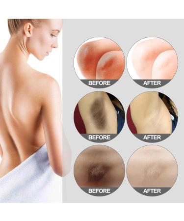  GNAUMORE Whitening cream for knees - Lightening cream for underarms - Lightening cream for inner thighs - Buy Online on GoSupps.com