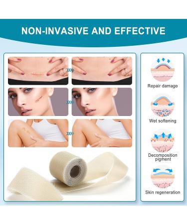 Silicone Scar Sheets Roll - Professional Reusable Scar Removal Tape for C-Section, Surgery, Burn, Keloid, Acne - 1.6 x 120 Roll - Buy Online on GoSupps.com