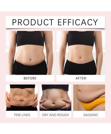 Skin Tightening Cream Body for Belly Fat Hibiscus & Honey Skin Firming Body Cream Cellulite Cream Hibiscus & Honey Body Shaping Cream Cellulite Remover Lifting Moisturizing Elasticity Natural - Buy Online on GoSupps.com