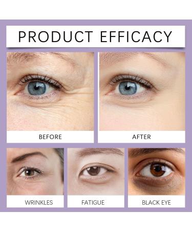  Eastuy Eye Contour Cream - 30g Smoothing Eye Cream Firming Moisturizing and Revitalizing for Sensitive and Mature Women for Daily Use in Repair and - Buy Online on GoSupps.com
