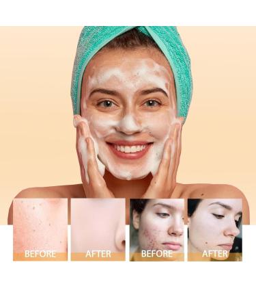 Vitamin C Hydrating Foaming Facial Cleanser - Gentle Acne-Prone Skin Wash with Silicone Brush - Vegan Daily Cleanser for Men & Women - 4.2oz - Buy Online on GoSupps.com