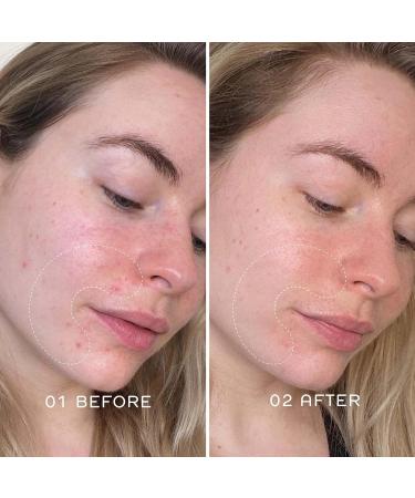 REN Clean Skincare Glow Tonic 16.9 Fl Oz - Daily Facial Brightening Exfoliant with AHAs & BHAs - Cruelty Free & Vegan Pore Reducing Toner - Buy Online on GoSupps.com