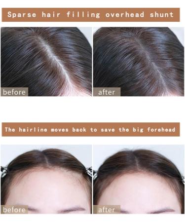 ONLYOILY Hairline Powder for Instant Root Touch Up & Hair Dye - Perfect for Cosmetic Quick Fixes & Makeup Removal Facial Suitable for All Hair Types 04 - Buy Online on GoSupps.com