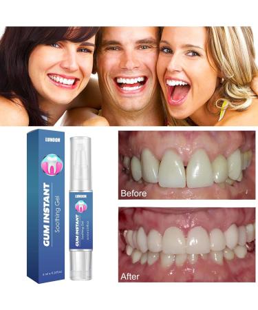 Attdx Gum Relief Gel - Periodontal Treatment & Instant Relief (5pcs) | Effective Gum Care Solution - Buy Online on GoSupps.com