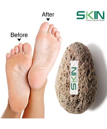 Skinapeel Large Pumice Stone - Natural Foot Care Scrubber & Callus Remover - Buy Online on GoSupps.com