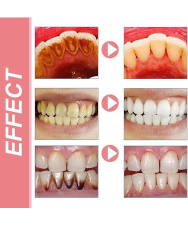 Baking Soda Toothpaste Oral Care 2024 New Baking Soda Toothpaste Teeth Whitening Toothpaste Baking Soda Deep Cleaning Fresh Breath Stain Removal Protect Teeth (3 Pcs) - Buy Online on GoSupps.com