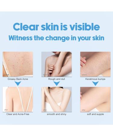  Ecoticfate Rubbing Mud Cream - Moisturizing Exfoliation Dead Skin Removal Whitening 350ml | Rubbing Mud Body Scrub Gentle Exfoliation Brightens Dull Complexion Ecoticfate - Buy Online on GoSupps.com