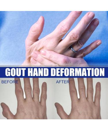 Googeer Lot de 2 gouttes de soin des reins base de plantes liquide d'essence relaxant et r parateur actif pour les articulations solution de soins base de plantes gouttes base de plantes 2 Pi ces. - Buy Online on GoSupps.com