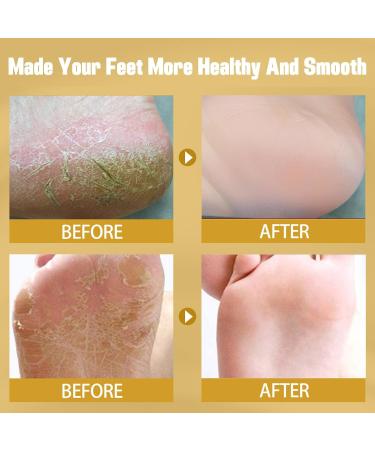 Cracked Heel Repair Foot Cream Cracking Cream Chapping Cream Winter Banana Anti-Cracking Frost Anti-Cracking Frost Feet Moisturizer Skin Repair Cream Anti-Drying Crack Cream - Buy Online on GoSupps.com