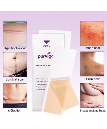 Silicone Scar Removal Sheets - Professional Strips for C-Section, Burns, Injuries & Acne - 5 Reusable Sheets - 5.9x1.6 - Buy Online on GoSupps.com