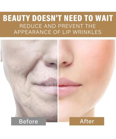 Buy Lip Lift Anti-Wrinkle Patches | Smooth Smile Lines & Fine Lines Fast - Gold Silicone Lip Mask - Buy Online on GoSupps.com