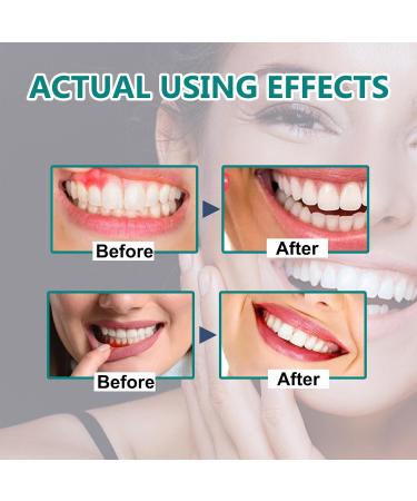  GNAUMORE Gum Growth Drops Gum Regeneration Drops Dental Care Protection For Everyone 30ml - Buy Online on GoSupps.com