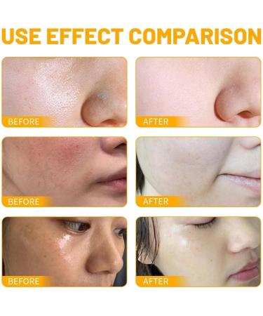 Turmeric Salicylic Acid Facial Cleanser - Turmeric Face Wash - Deep Cleansing Foaming Turmeric Face Cleanser - Face Care - Face Wash Women - Clean and Clear Face Wash for Removing Acne & Impurities - Buy Online on GoSupps.com