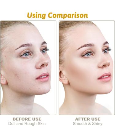Niacinamide Face Serum 10% Niacinamide Serum + 1% Zinc Serum Face Moisturiser High Strength Vitamin Nourish Skincare Anti Aging Dark Spot Remover for Face Glow Skin Correcting (30ML) - Buy Online on GoSupps.com