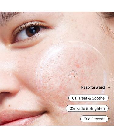 PSA Silver Lining Dioic & Willowherb Clarifying Cream - Blemish & Breakout Moisturiser 50ml - International Shipping Available - Buy Online on GoSupps.com