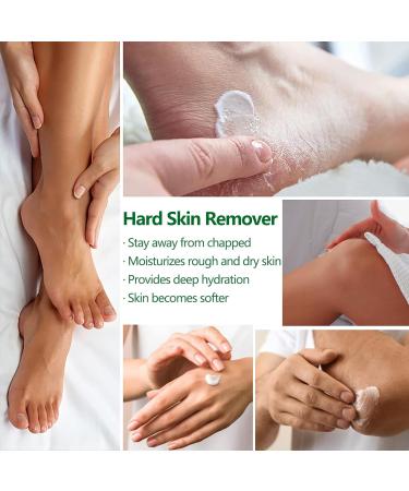 40% Urea Foot Cream - Moisturizing Urea Cream for Very Dry Feet - Cracked Heel Repair Cream for Foot Care - Heel Cream for Deep Cracked Skin - Feet Cream for Calluses and Hard Skin - Buy Online on GoSupps.com
