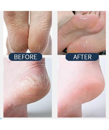  ZLHHRZJX Hand and foot cream for dry and chapped skin repairing cream for cracked heels moisturizing foot care body lotion for dry skin non-greasy care easy to carry (3 PCS) - Buy Online on GoSupps.com