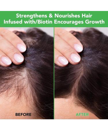 Rosemary Hair Mask for Hair Growth & Deep Conditioning | Hydrating Scalp Treatment for All Hair Types - Buy Online on GoSupps.com