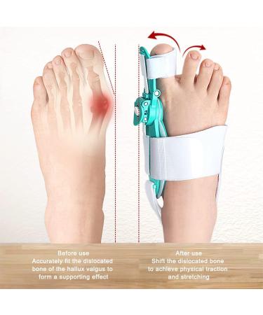 Bunion Corrector Day Night Support for Hallux Valgus Toe Straightener - Adjustable with PU Side Pad and ABS Support (Green) - Buy Online on GoSupps.com