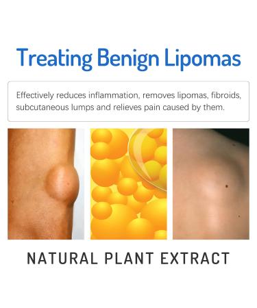 Garner Skin Lump-Free Lipoma Removal Ointment - Natural Vegetable Formula for Clump Removal, Anti-Swelling, Body Care - 1pc - Buy Online on GoSupps.com