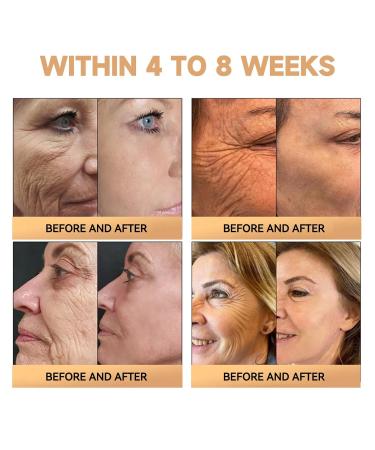 dooeka PLTOWE Super Anti-Aging Cream 2024 Latest Professional Bee Venom Treatment Cream Hydrating & Moisturizing for All Skin Types and Body Areas (2Pack) - Buy Online on GoSupps.com