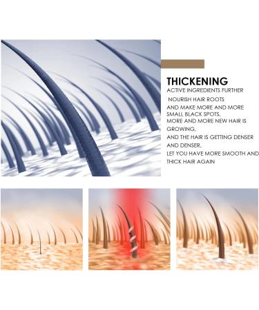  Pemarlis 100g Rice Shampoo Bar Shampoo Bar Natural Rice Soap For Thinning Hair And Hair Loss Effectively Promotes Hair Growth - Buy Online on GoSupps.com