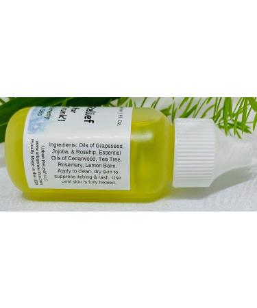 Urban ReLeaf Jock Itch Relief - Fast Relief for Men's Intimate Area, Stops Itching and Redness, 100% Natural Essential Oils, Effective Remedy - Buy Online on GoSupps.com