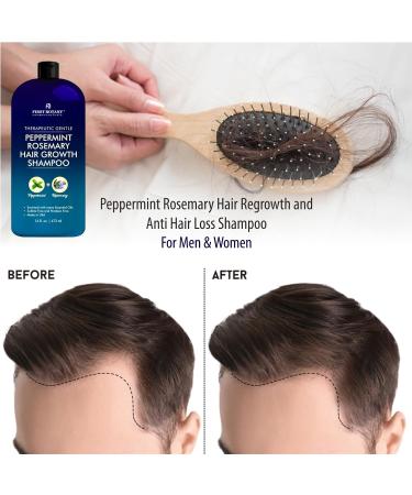 Peppermint Rosemary Hair Regrowth Shampoo - Anti Hair Loss Hydrating & Volumizing for Men & Women | 16 fl oz International Shipping - Buy Online on GoSupps.com