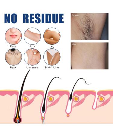 50ml Body Hair Removal Mousse Male and Female Specific Packaging Gentle Painless Hair Removal Spray All Skin Types Chest Legs Under Arms Private Area for Unwanted Hair (2 Mix) - Buy Online on GoSupps.com
