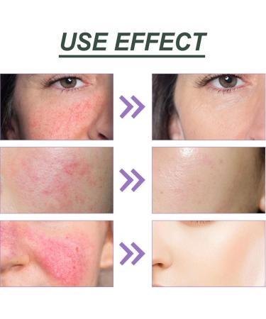 Beef Tallow Sunscreen Balm Balm High-Efficiency Sunscreen Natural Non Nano-Zinc Sun Cream for Face Korean Sunscreen Beef Tallow and Zinc Sun Balm Moisturizer Suncream Sunscreen Skin Care Cream - Buy Online on GoSupps.com